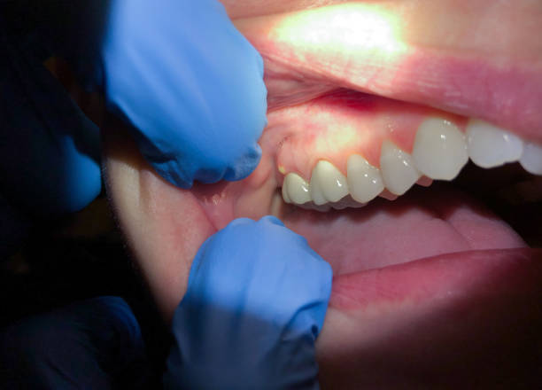  Barbourville, KY Emergency Dentist Pros