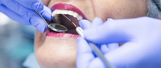 Best Emergency Wisdom Tooth Extraction in Barbourville, KY